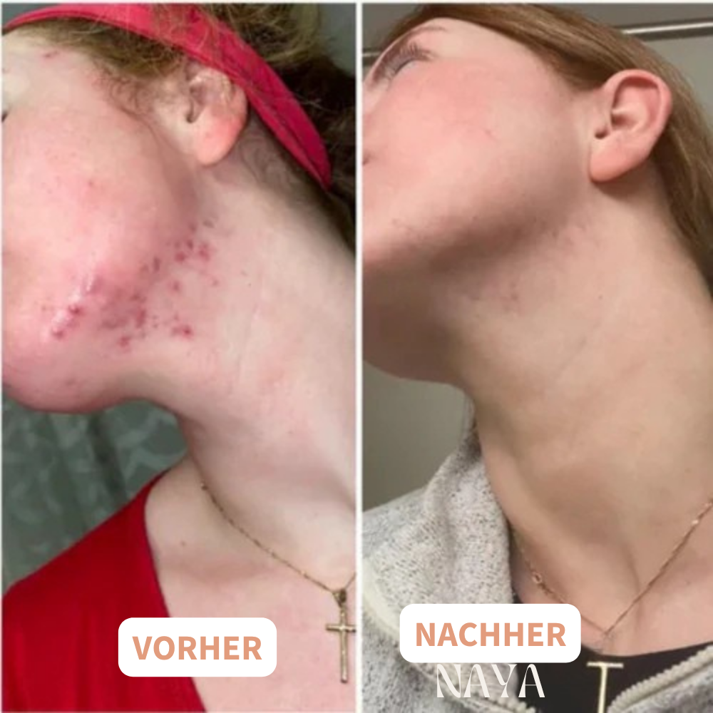NAYA - Bringen Sie Ihre Hormone natürlich ins Gleichgewicht