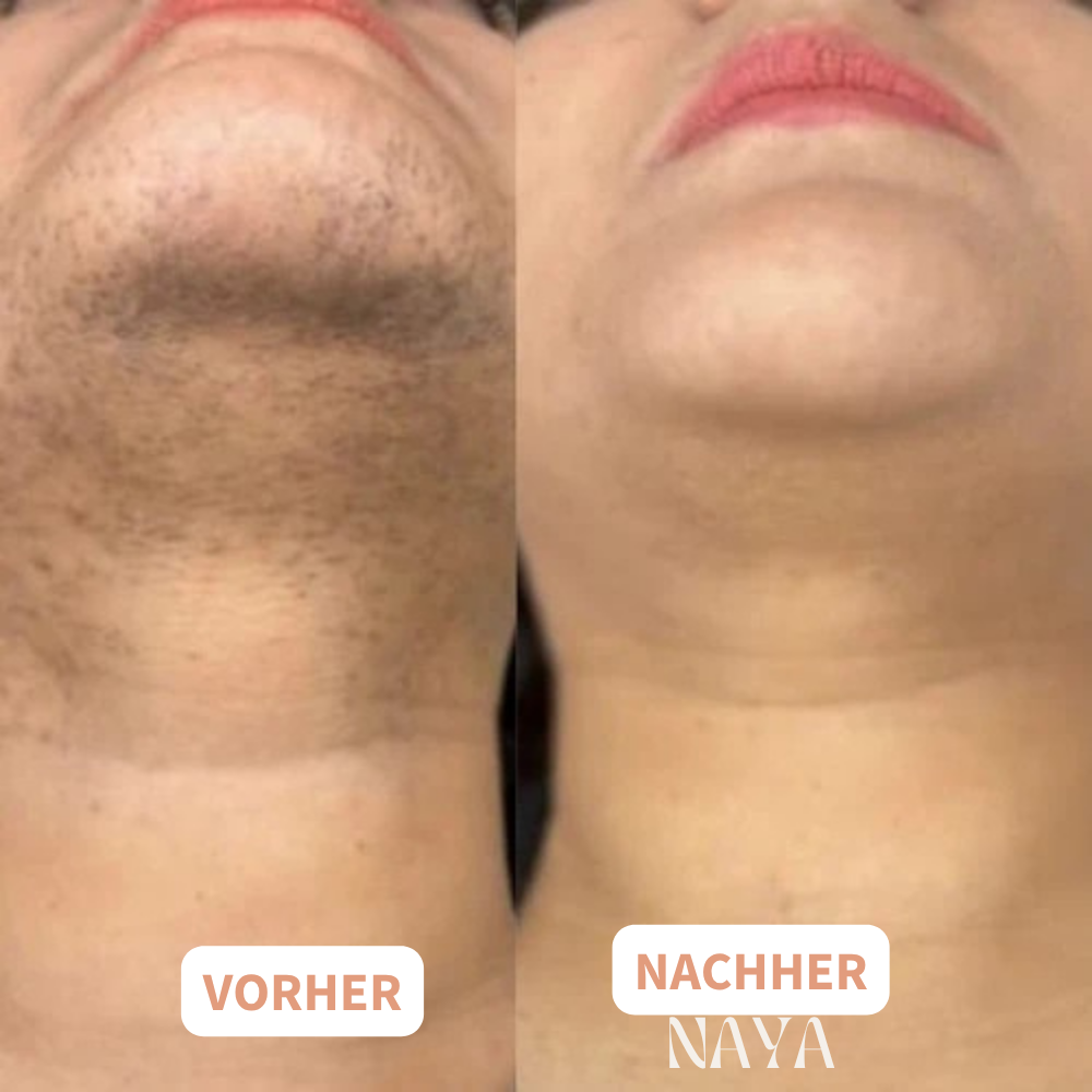 NAYA - Bringen Sie Ihre Hormone natürlich ins Gleichgewicht